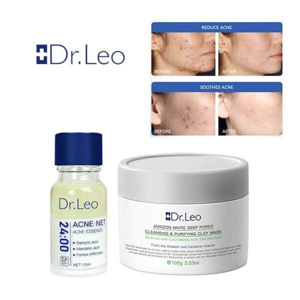 Dr.Leo Acne Essence + Dr.Leo Cleansing Clay Mask Acne Treatment Tighten Pores