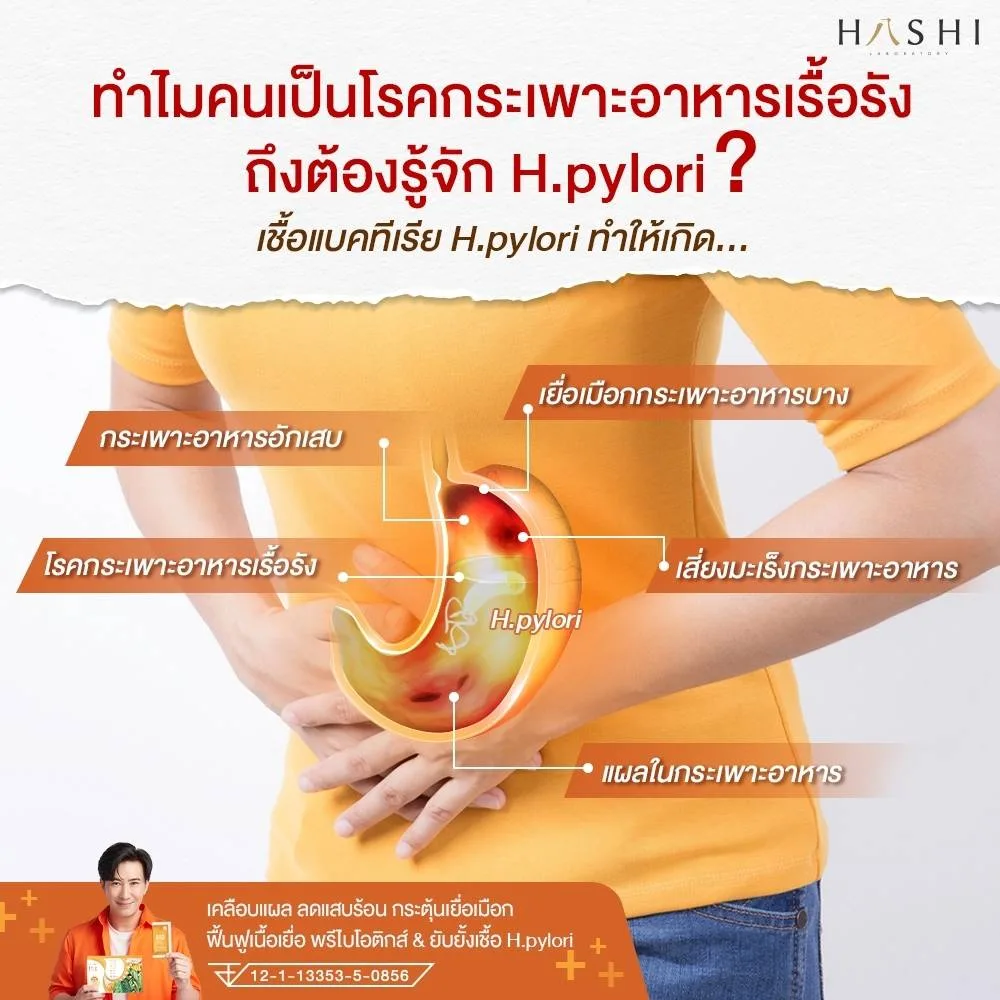 Hashi URD Coating Stomach Ulcers Without Antacids 12 Sachets - Image 4